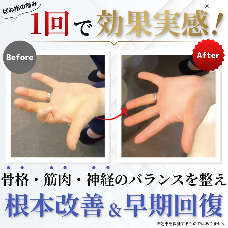 ばね指の痛みを根本改善、早期回復