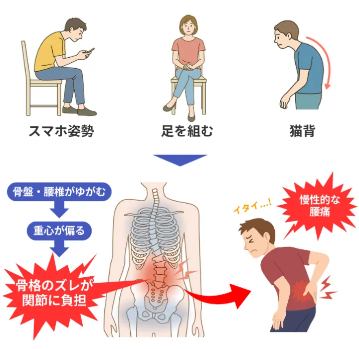 スマホ姿勢・足を組む・猫背が関節に負担をかけ痛みが発生