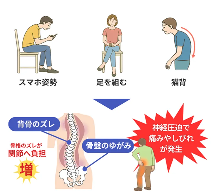 スマホ姿勢・足を組む・猫背が関節への負担増加