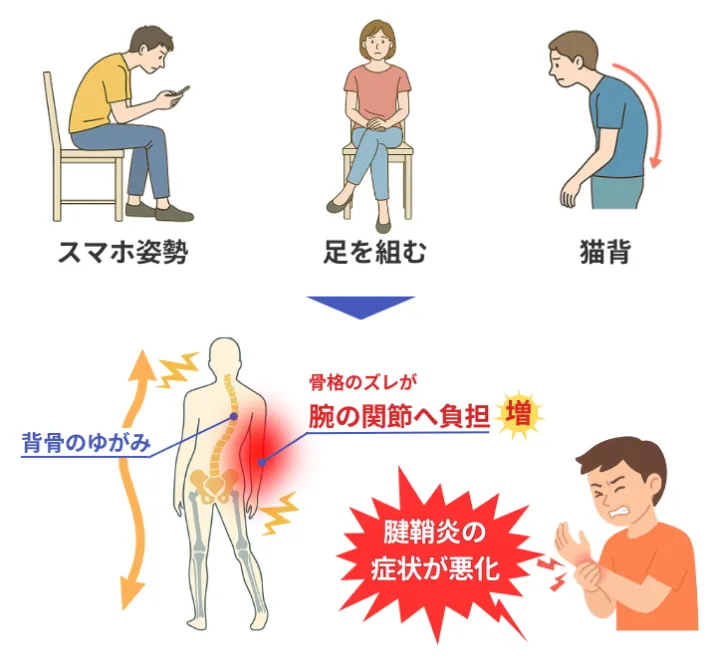 スマホ姿勢・足を組む・猫背が関節への負担増加