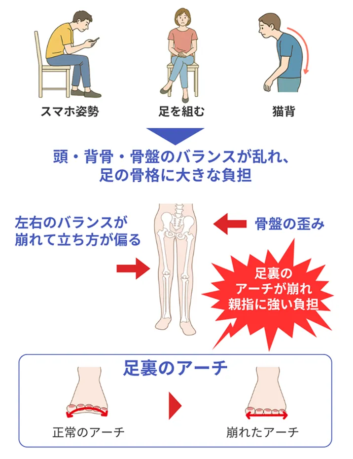 スマホ姿勢・足を組む・猫背が関節への負担増加