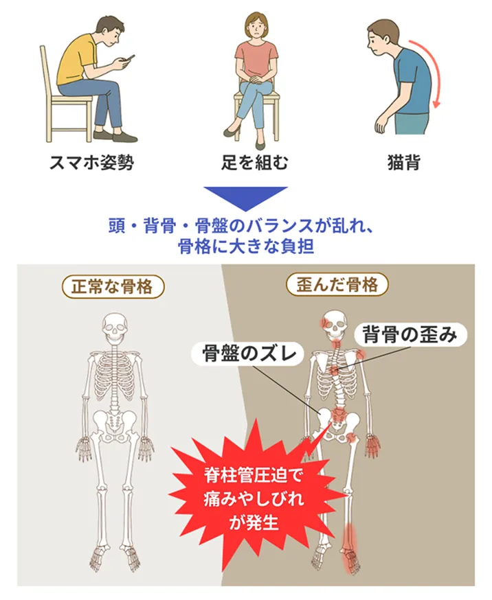 スマホ姿勢・足を組む・猫背が関節への負担増加